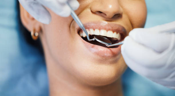Best Broken or Chipped Tooth Repair in Valley Cottage, NY